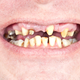 Illustration for article titled Scientists Grow Teeth From Scratch in the Worst Imaginable Way